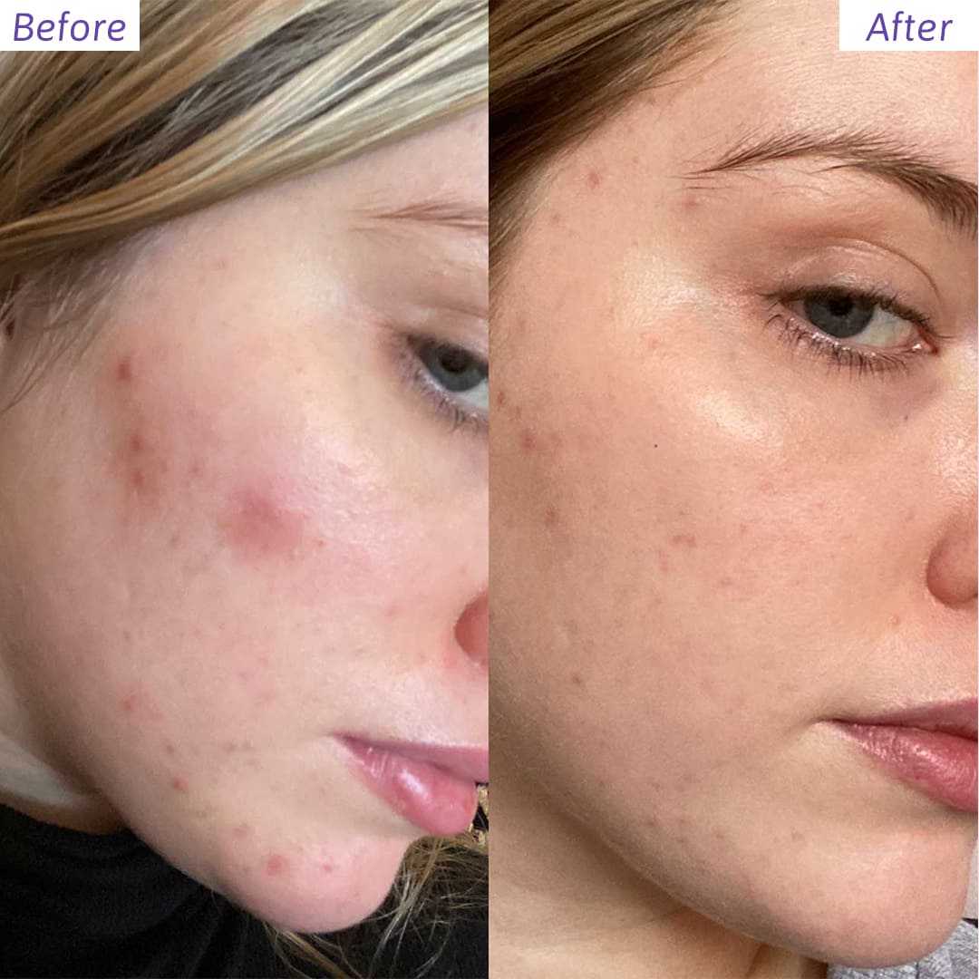 THE COMPLETE HYDRATION BUCKET