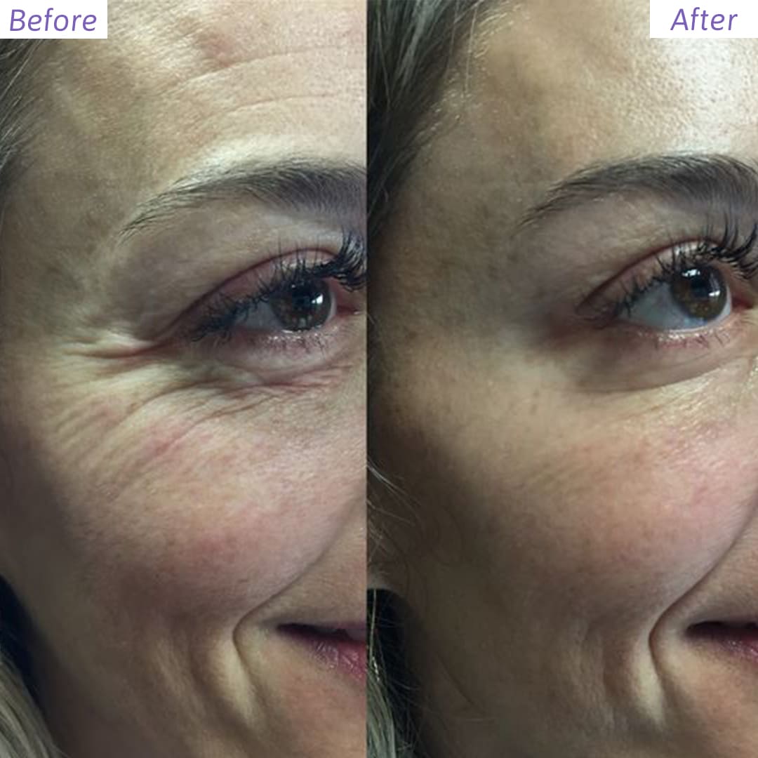 OVERNIGHT RECOVERY DUO